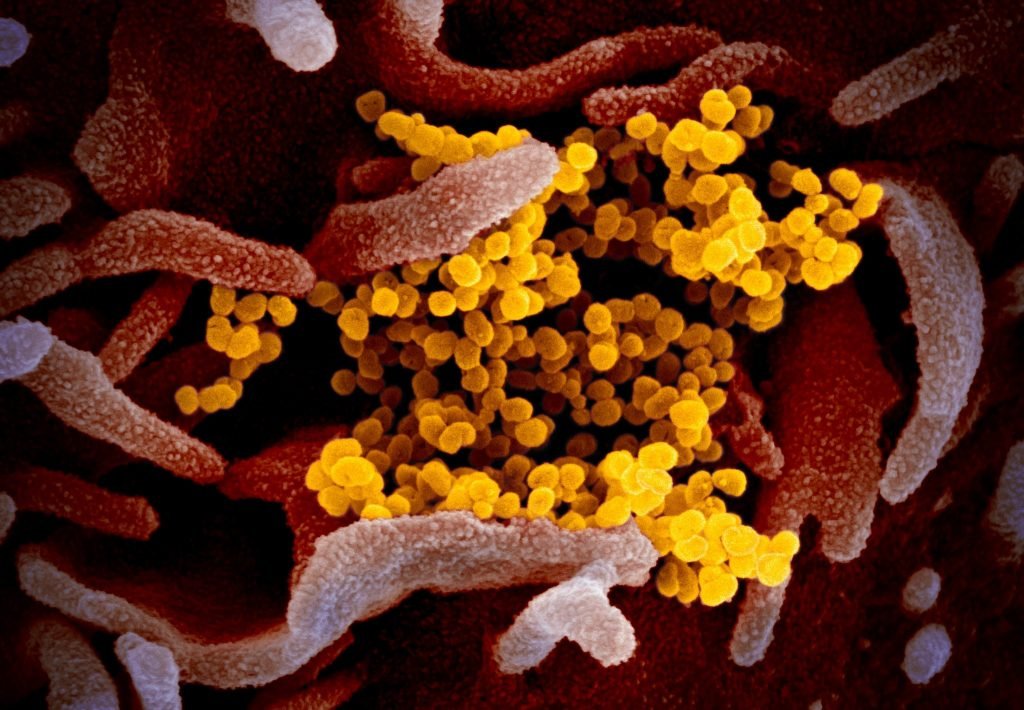 Illumina CEO says U.S. lags behind on catching COVID-19 mutations: CNBC